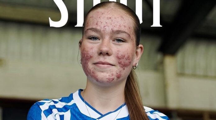 Skye Stout ecosse féminine féminin
